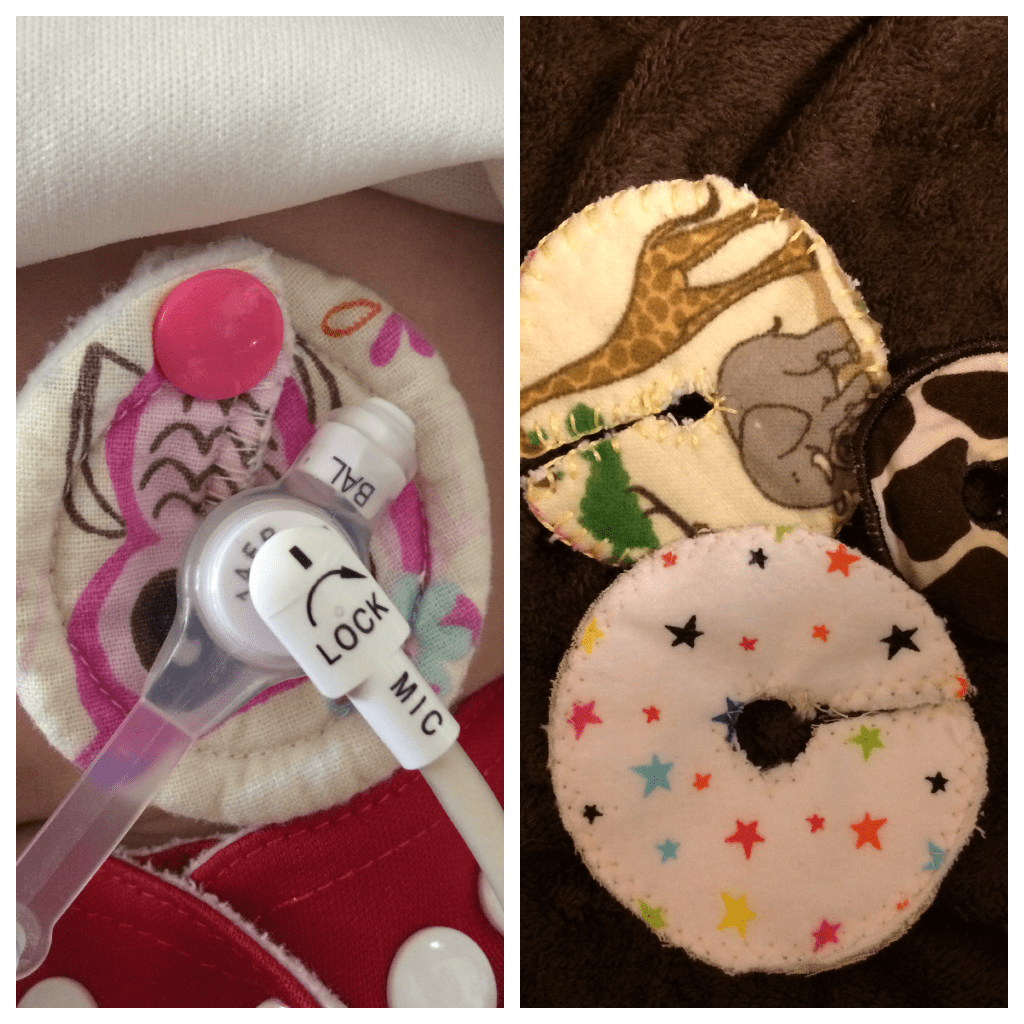Life with a Feeding&nbsp;Tube