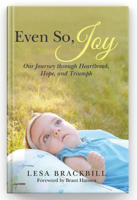 Even So Joy Hardcover